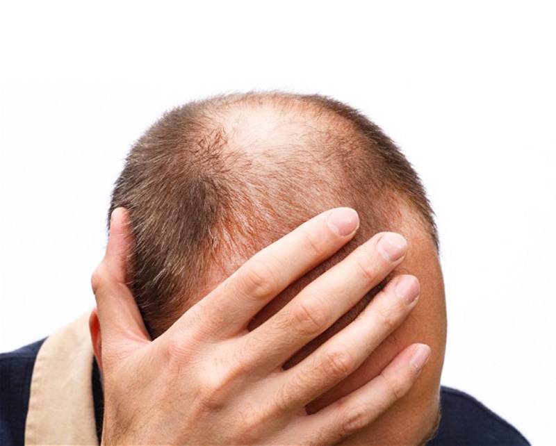 how to regrow hair after stress loss